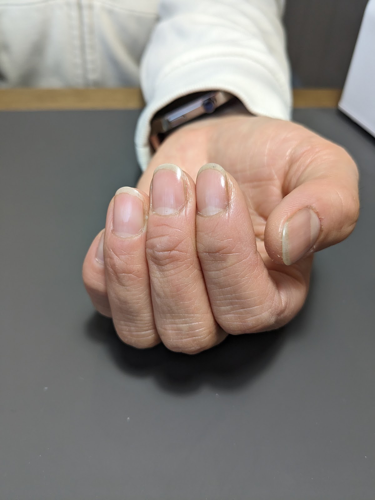 施術前
